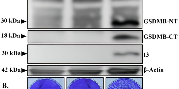 Researchers study how the mpox virus infiltrates brain cells