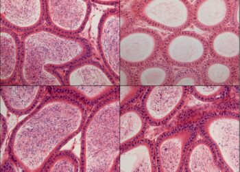 Scientists discover new target for reversible, non-hormonal male birth control