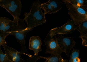 Scientists find that a protein associated with neurodegenerative diseases is also linked to childhood brain cancer