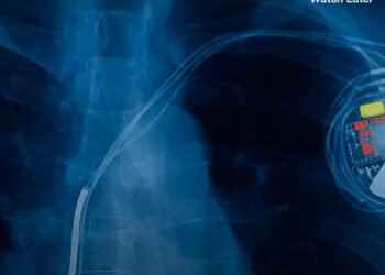 Scientists invent ultra-thin, minimally invasive, light-controlled pacemaker