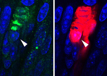 Study finds Schwann cells play critical role in pain and tactile sensations