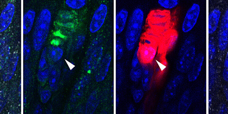 Study finds Schwann cells play critical role in pain and tactile sensations