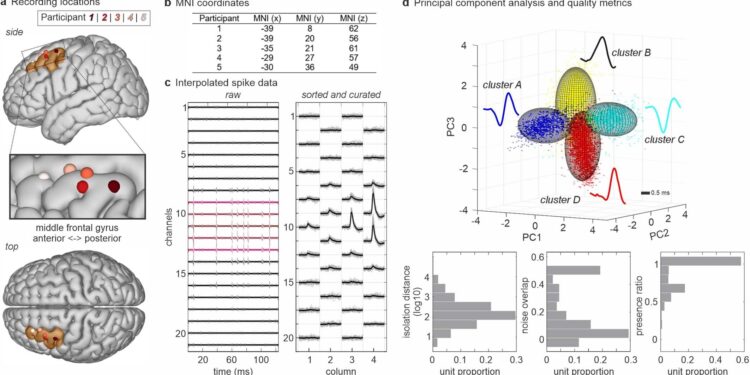 Study finds neurons in human brain capable of predicting what we’re going to say before we say it