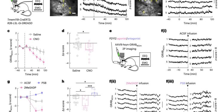 Study reveals microglia may regulate sleep via modulation of norepinephrine transmission