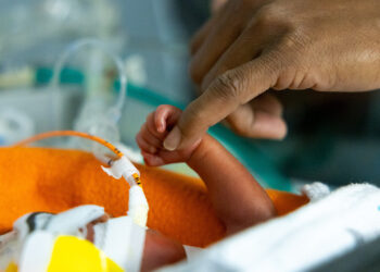 Study shows value of donated breast milk for extremely premature infants