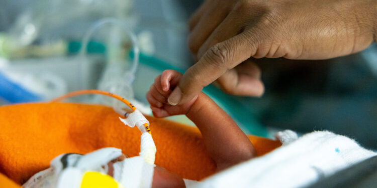 Study shows value of donated breast milk for extremely premature infants