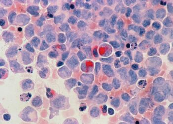 Targeting treatment resistance in chronic lymphocytic leukemia with a compound that goes beyond current BTK inhibitors