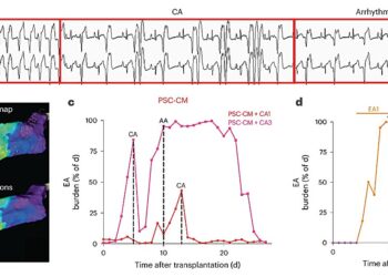 Treating and preventing abnormal heartbeats with muscle stem cell transplants