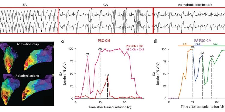 Treating and preventing abnormal heartbeats with muscle stem cell transplants