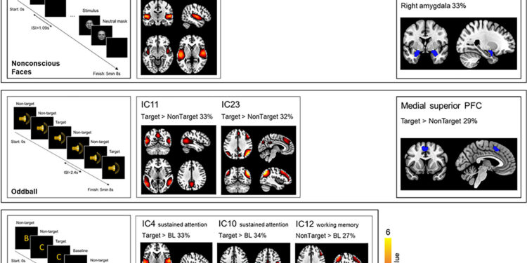 Twin study sheds light on hereditary brain activity
