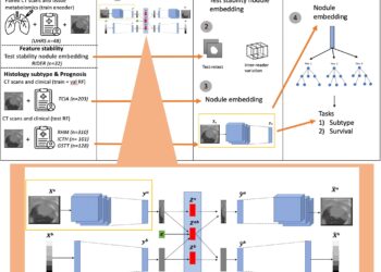 ‘Virtual biopsy’ uses AI to help doctors assess lung cancer