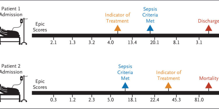 Widely used AI tool for early detection of sepsis could allay doctors’ suspicions