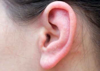 his ear is transformed into foul-smelling “apple jelly”