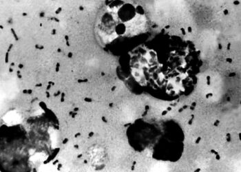 First person dies of plague in US in years