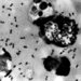 First person dies of plague in US in years