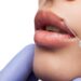 Fake Botox injections: call for vigilance after two hospitalizations