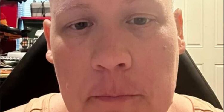 Medical error: she undergoes intensive chemotherapy… before learning that she never had cancer