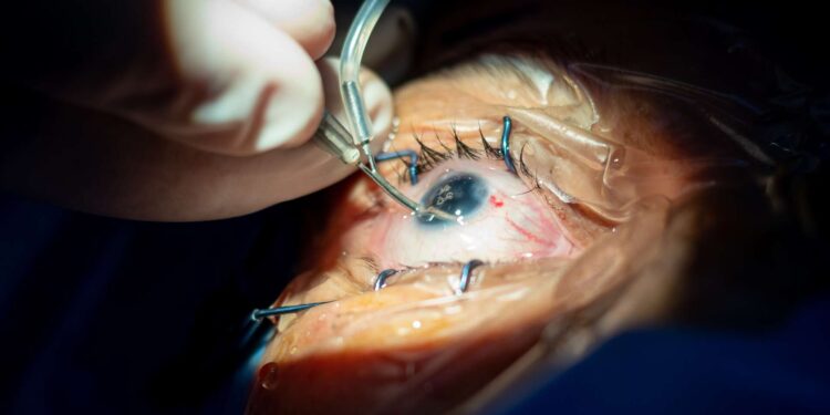 he gets the whites of his eyes tattooed and the situation escalates