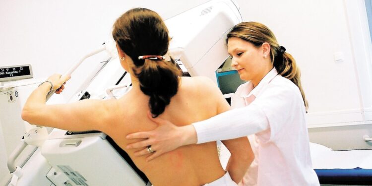 Mammograms recommended from age 40 in the United States