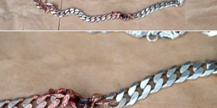 Saved by his metal chain: man narrowly survives gunshot wound