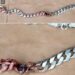 Saved by his metal chain: man narrowly survives gunshot wound