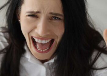 Suffering from Rapunzel syndrome, a huge mass of hair perforates her stomach