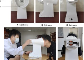 AI-based tongue imaging could help non-invasive detection of coronary heart disease