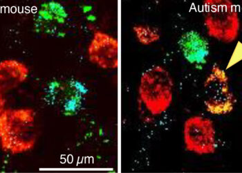 Autism spectrum disorders linked to neurotransmitter switching in the brain