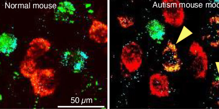Autism spectrum disorders linked to neurotransmitter switching in the brain