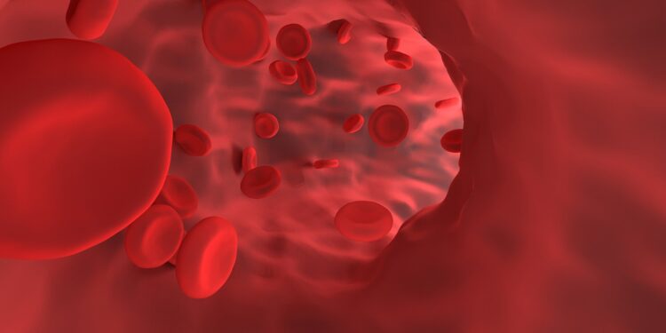 Big Data and Artificial Intelligence-Based Research Improves Understanding of Systemic Vasculitis