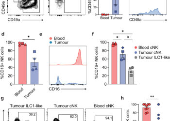 Bladder cancer discovery opens door to potential new therapeutic avenue