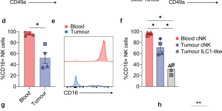Bladder cancer discovery opens door to potential new therapeutic avenue