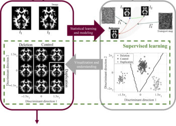 Collaborative research cracks the autism code and makes the neurodivergent brain visible