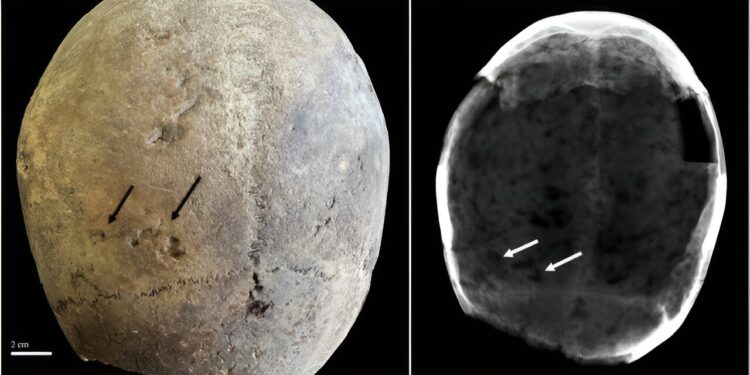 Evidence of cocaine use by Europeans dates back to the 17th century.