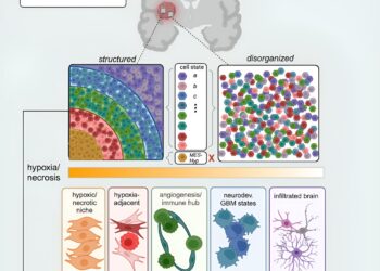High-resolution mapping of brain tumors reveals possible reason why some patients don’t respond to new drug