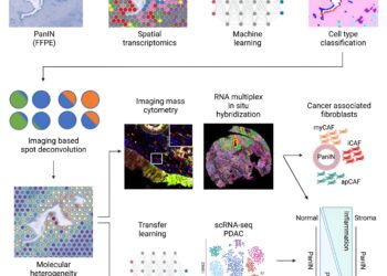 Identifying key markers of pancreatic cancer progression using a novel analysis pipeline