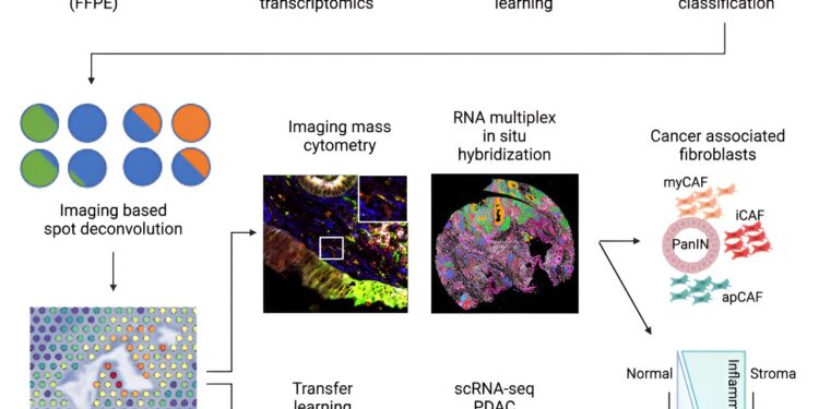 Identifying key markers of pancreatic cancer progression using a novel analysis pipeline