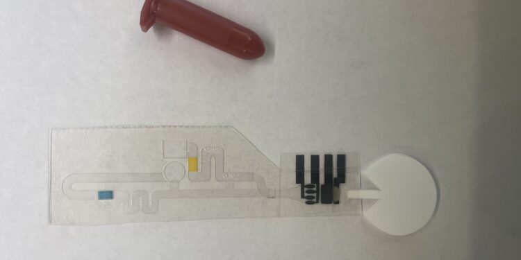 Improving access to heart failure screening with a low-cost saliva test