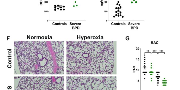 Inhalation of live lactobacilli reduces lung inflammation and improves lung function, preclinical study finds