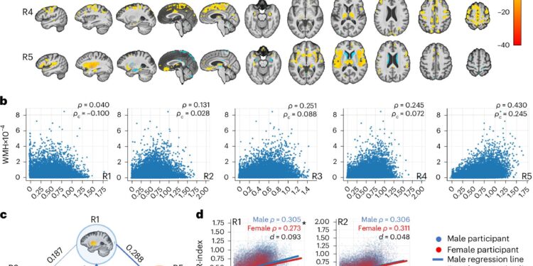 Large-scale brain imaging study reveals five patterns of age-related degeneration