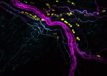 Mechanisms of postoperative pain reveal a path toward localized and targeted therapy