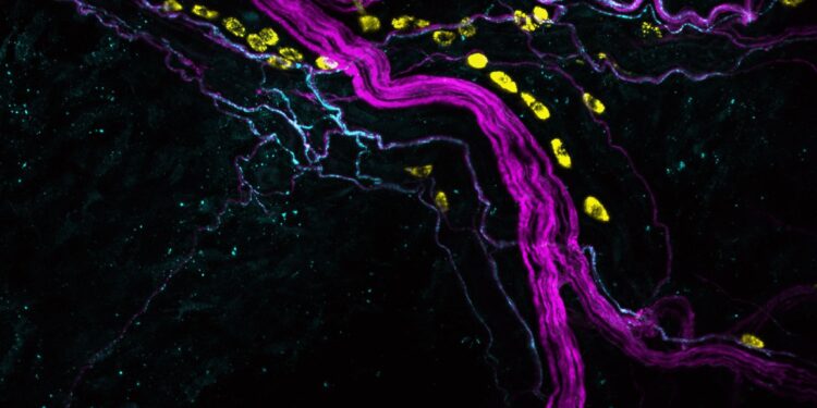 Mechanisms of postoperative pain reveal a path toward localized and targeted therapy