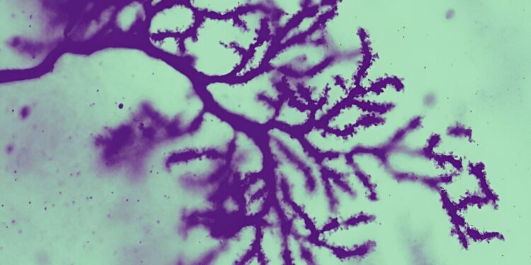 Mouse study shows knocking out key gene leads to autistic traits