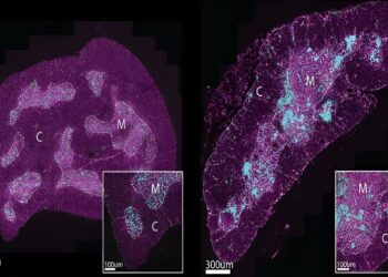 New Clue to the Curious Case of Our Aging Immune System