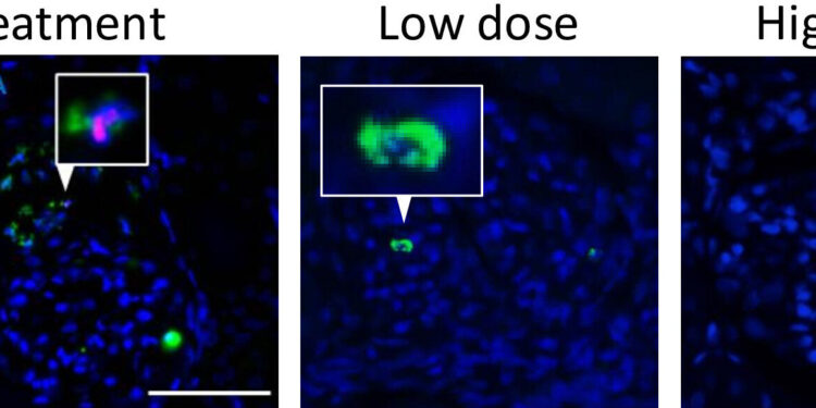 New Compound Shows Great Potential for Patients with Neutrophil-Associated Inflammation