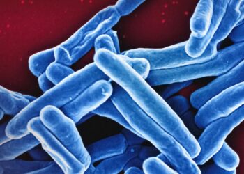 New findings on tuberculosis could change the way we treat inflammatory diseases