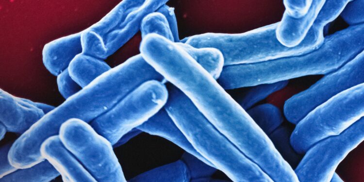 New findings on tuberculosis could change the way we treat inflammatory diseases
