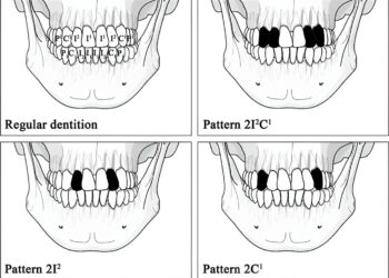 New insights into the origins and motivations of ritual tooth extraction in ancient Taiwan
