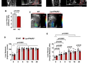 New pathway could lead to potential treatment for metabolic liver disease