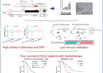 New prognostic biomarker identified in small cell lung cancer